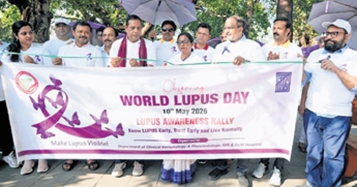 Experts Highlight Importance of Early Diagnosis and Lifestyle Changes in Managing Lupus