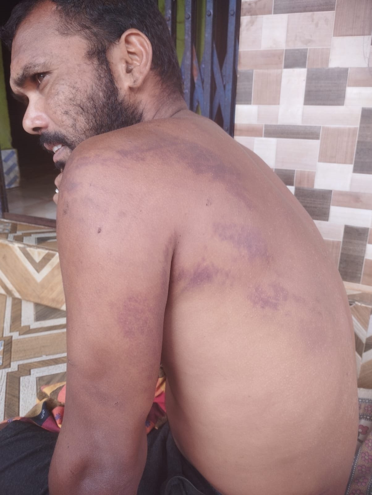 Two Men in Koraput Critical After Alleged Torture by Andhra Pradesh Police